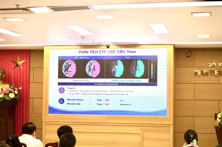 SINH HOẠT KHOA HỌC CHUYÊN ĐỀ: ỨNG DỤNG CT PERFUSION TRONG ĐỘT QUỴ NÃO