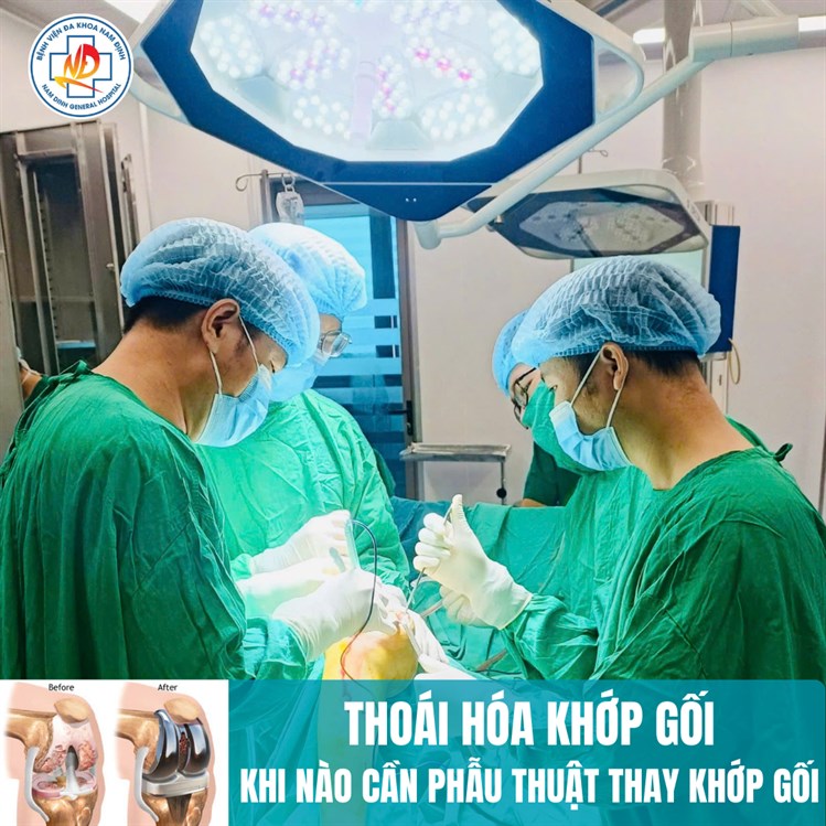 THOÁI HÓA KHỚP GỐI - KHI NÀO CẦN PHẪU THUẬT THAY KHỚP GỐI